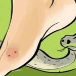 Centre declares snakebites a notifiable disease in India